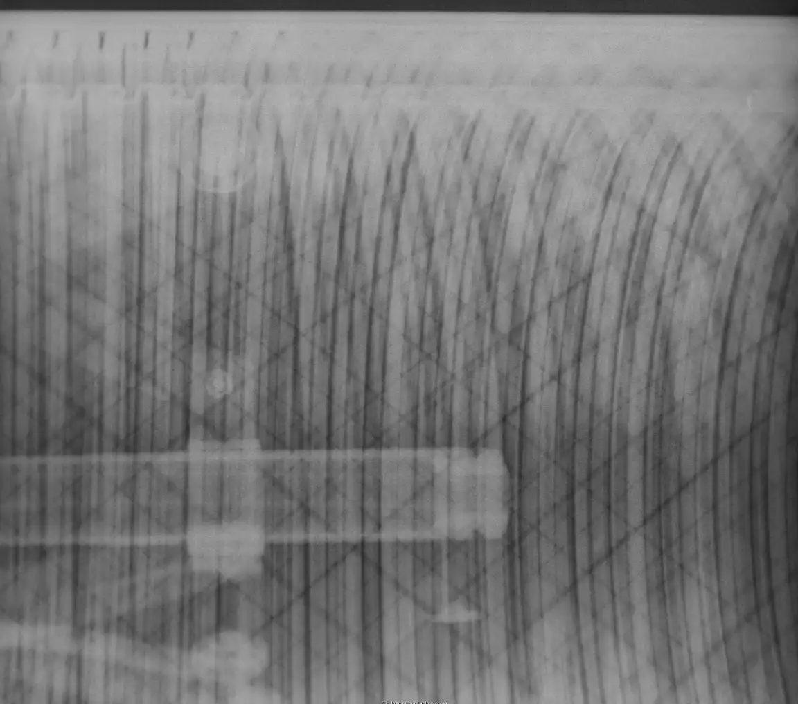 X ray image of flexible riser showing internal components